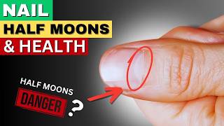 What Your Nail Half Moons Reveal About Your Health [upl. by Yentuoc]