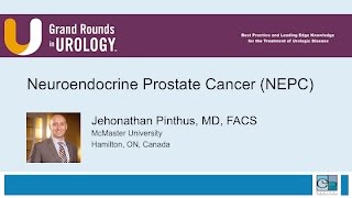 Neuroendocrine Prostate Cancer NEPC [upl. by Odrarej]