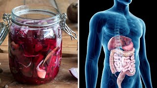 How To Make Beet Kvass  A Cleansing Medicinal Tonic [upl. by Jarl366]