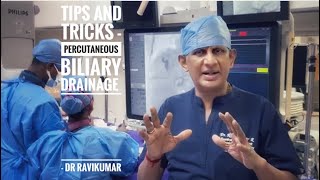 Percutaneous Biliary Drainage Tips and Tricks  Dr RaviKumar  ISVIR TNPY [upl. by Emarej]