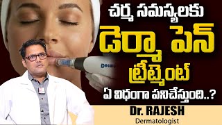 Dermapen Treatment  How to use Dermapen In Telugu  DrRajesh  Layers Skin  Hair  Laser Clinic [upl. by Delastre]