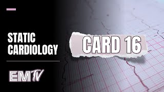 Static Cardiology CARD 16 [upl. by Releyks429]