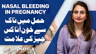 Nasal Bleeding In Pregnancy is it normal How To Stop Bleeding Nose  Shamayela Hanif  Gynecologist [upl. by Newkirk570]