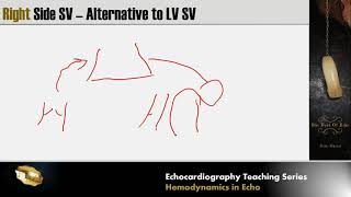 Lecture 8  Hemodynamics in Echocardiography [upl. by Pontias]