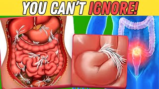 How Intestinal Blockages Threaten Your Health – Know the Risks [upl. by Zeuqram]