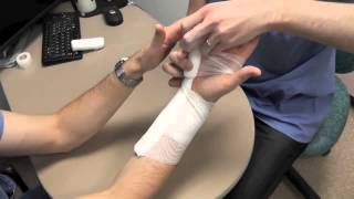 Ulnar Gutter Splint Howto [upl. by Hitchcock611]