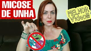 O quotMELHORquot vídeo sobre MICOSE DE UNHAS 👌 Tudooooo sobre o assunto [upl. by Driskill]