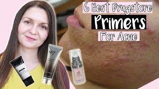 Best Drugstore Primers For Acne Prone Skin 2019  Noncomedogenic Primers [upl. by Enialedam]