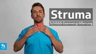 Struma Schilddrüsenvergrößerung verstehen Ursachen Symptome Diagnose amp Therapie  DocTommy [upl. by Rehtul]