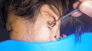 Removing Grandmas 70 Year Old Earwax  Its STUCK [upl. by Ainerbas]