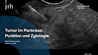 Pankreastumor Biopsie und Zytologie [upl. by Viki]