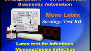 Mono Infectious Mononucleosis Serology kit [upl. by Gaudette]