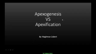 Apexogenesis [upl. by Attelrahc]