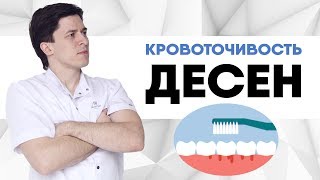 Кровоточивость десен Что делать если кровят десна при чистке зубов Как укрепить десна [upl. by Hareehat]