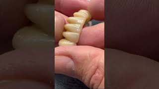 Zirconium bridge polishing teeth dentalprosthesis dentistry [upl. by Standush]