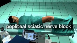 Popliteal Sciatic Nerve Block [upl. by Naimad]