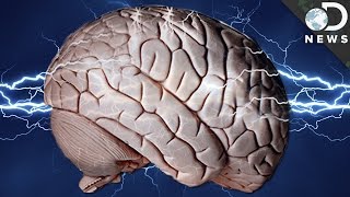 Can Shocking Your Brain Make You Smarter [upl. by Fink]