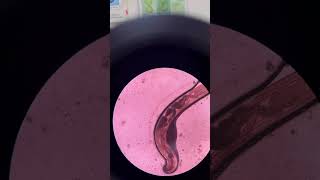 Enterobius vermicularis medtech parasite microscopy [upl. by Iey]