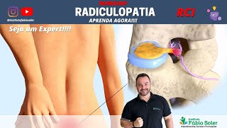 COMO TRATAR A RADICULOPATIA COM TRATAMENTO COMPLETO EM RCI [upl. by Harat161]