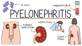 Understanding Pyelonephritis Kidney Infections [upl. by Phail]