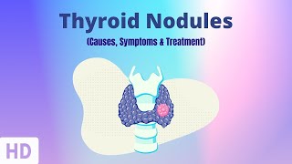 Thyroid Nodules Causes Symptoms and Treatment [upl. by Aihsakal]