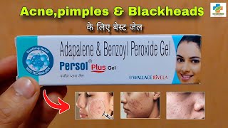 Persol Plus Gel Use in Hindi  Acnepimples Blackhead  Adapalene amp Benzoyl peroxide SK MEDICINE [upl. by Caterina322]