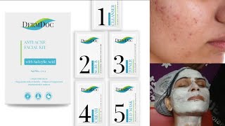 DermDoc Anti Acne Facial Kit Salicylic Acid For Oily Combination Acne Prone Skinreelsviral viral [upl. by Sammons831]