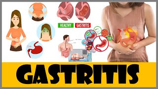 Gastritis Acute gastritis Chronic gastritis Symptoms and Diagnosis [upl. by Aitnyc]