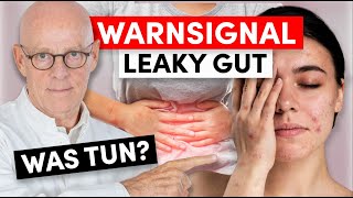 Anzeichen Leaky Gut Was dahinter steckt und was sie tun können wichtig [upl. by Je424]