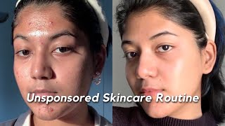 How I got rid of my ACNE SCARS amp TEXTURE  My Unsponsored Skincare Routine 🧴🫧🧖 [upl. by Eseeryt]