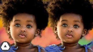 10 Rarest Black Twins Who Are One In a Million [upl. by Arahsat]