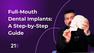 FullMouth Dental Implants StepbyStep Guide Procedure at 21D [upl. by Levitt975]