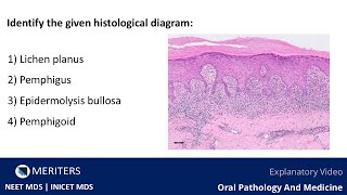 NEET MDS  INICET  OPM  Skin And Vesiculobullous Lesions  Explanatory Video  MERITERS [upl. by Holly-Anne]