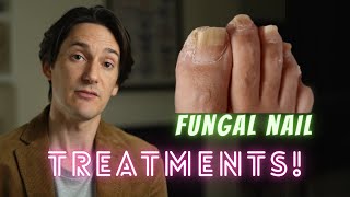 Fungal Nail Treatments [upl. by Banna]