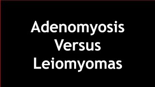 Adenomyosis Versus Leiomyomas on Ultrasound [upl. by Areip]