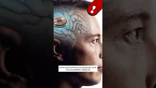 Elon Musk diz que pretende implantar chip cerebral em mais pessoas ainda neste ano [upl. by Beckett]