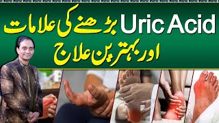 Uric Acid Symptoms and Treatment  Uric Acid Diet Plan and Foods To Avoid  Uric Acid Ka ilaj [upl. by Ahsyia]