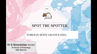 FOREIGN BODY GRANULOMA UG SPOTTERS  RATS  MBBS SRMMCM RC  Dr GSS [upl. by Nizam]