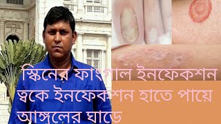 Grisovin FP tablet use in বাংলা2021 [upl. by Devol]