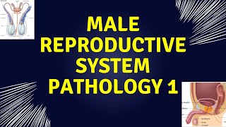 pathoma male reproductive system penis and testicle pathology [upl. by Notyad491]