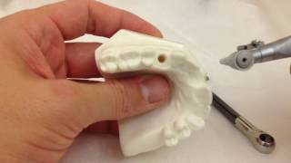 Tutorial of CeraRoot 34 zirconia implant placement PREMOLAR [upl. by Enidlarej]