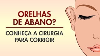 OTOPLASTIA ORELHA DE ABANO COMO É FEITA DREAM PLASTIC  CIRURGIA PLÁSTICA [upl. by Emmalee]