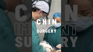 Chin augmentation goes beyond simple enhancement—it can also refine the lower third of the face [upl. by Pfister]