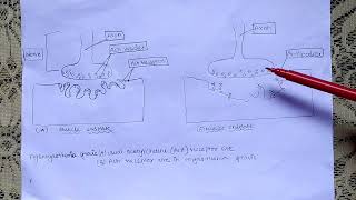 myasthenia gravis BSc nursing 3rd year medical surgical nursing2 [upl. by Meehsar]