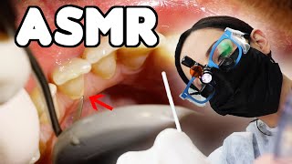 ASMR Dental Cleaning  LOTS of Scraping [upl. by Noissap]