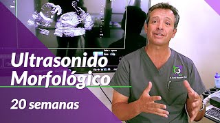 Es niño ❤️❤️ FETO 20 SEMANAS EMBARAZO 🤰 Desarrollo video ecografía en 3d💖 5º mes [upl. by Alikam]