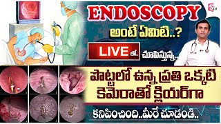 కడుపులో సమస్యలు  Know About Colonoscopy And Endoscopy  Gleneagles Hospital  DrGSSameer Kumar [upl. by Massimiliano]