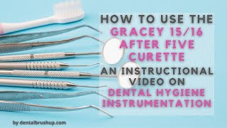 How to use the Gracey 1516 After Five Curette [upl. by Ecnarf611]