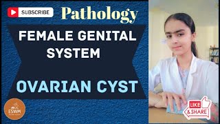 Ovarian Cyst PATHOLOGY Explained [upl. by Akirdnahs]