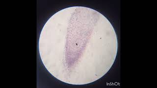 Microscopic view of Mitosis stages in Onion Root Tip microscopic mitosis prophase metaphase [upl. by Sumner337]